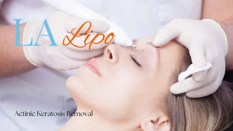 Woman receiving Actinic Keratosis Removal Treatment Kingstanding