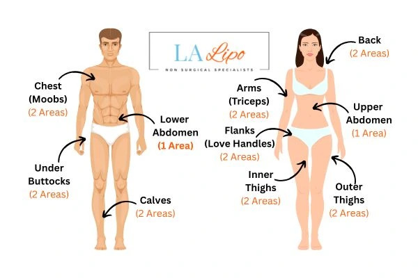 LA LIPO Cryolipolysis Areas Kingstanding