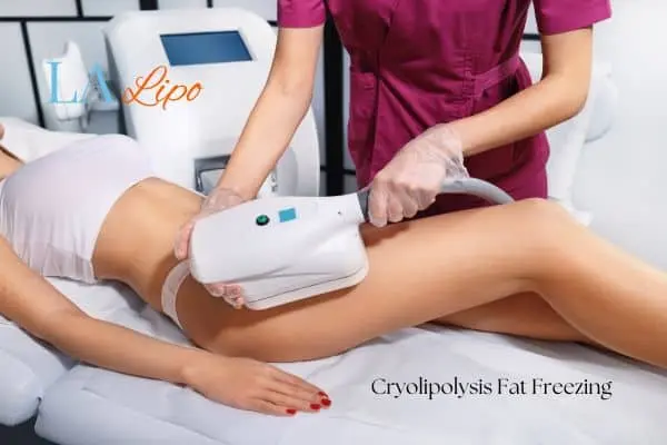 Woman receiving coolsculpting Kingstanding treatment on her thighs