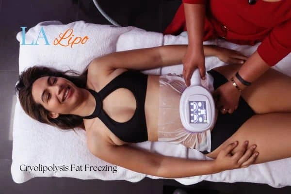woman getting cryolipolysis Kingstanding