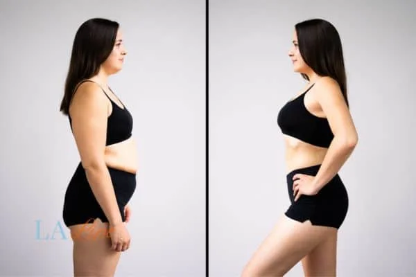 link between body image and mental health Kingstanding