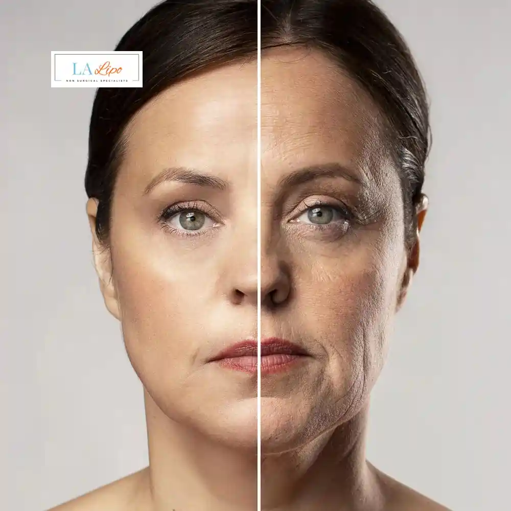 How Can You Tell If Non-Surgical Skin Tightening Is Right for You Kingstanding?