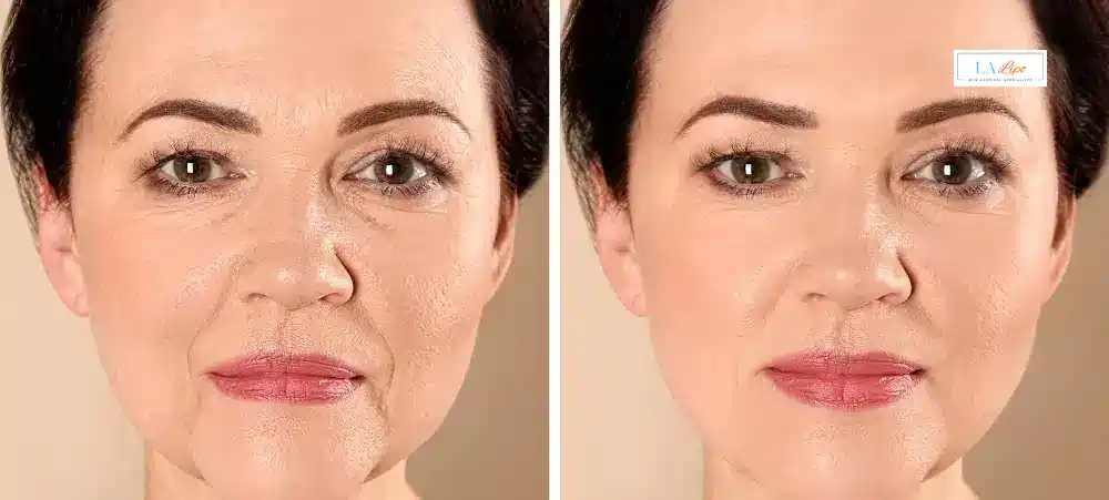 How Long Does It Take to See Results and How Long Do They Last Kingstanding?