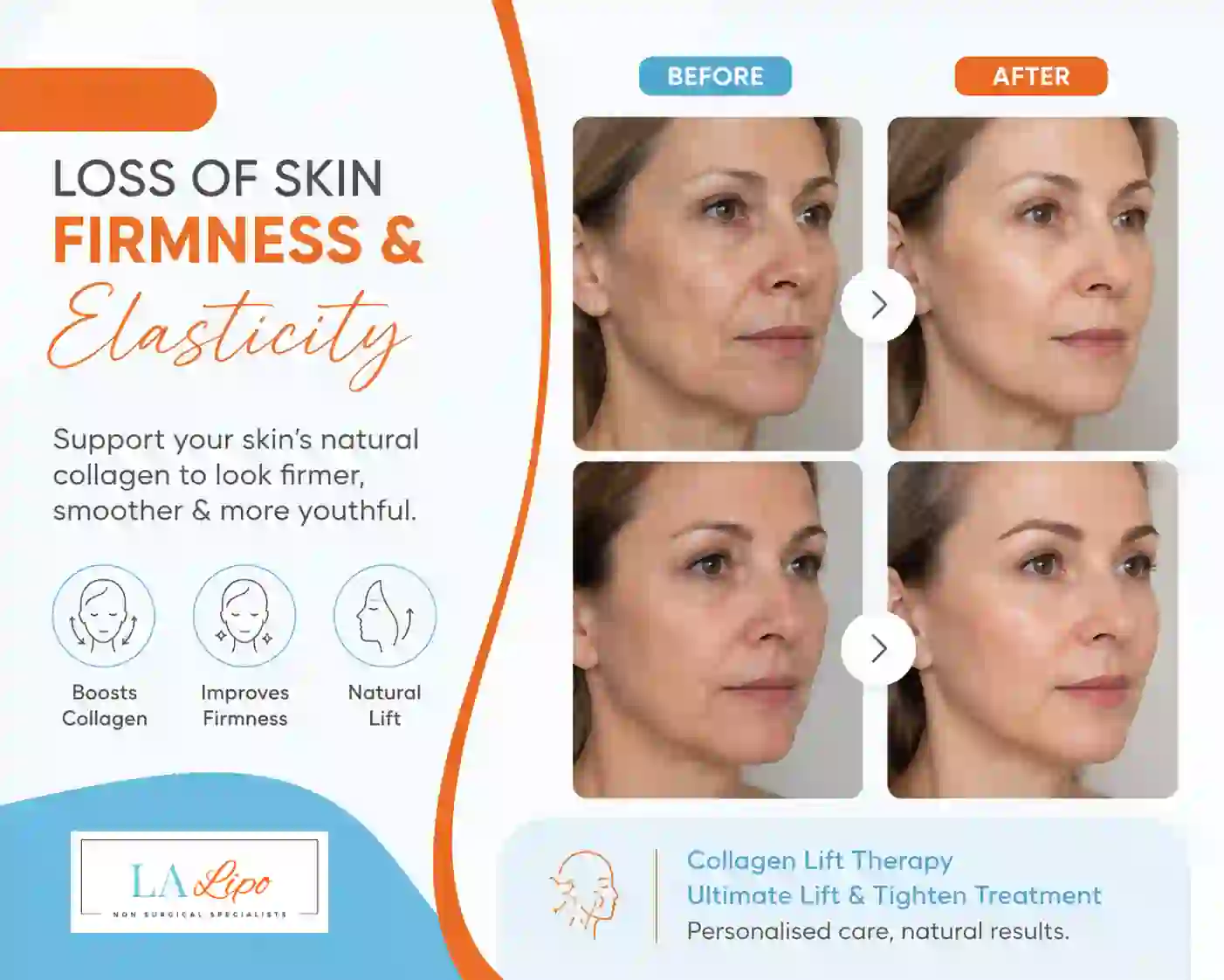 Sign #7: Loss of Skin Firmness and Elasticity Kingstanding