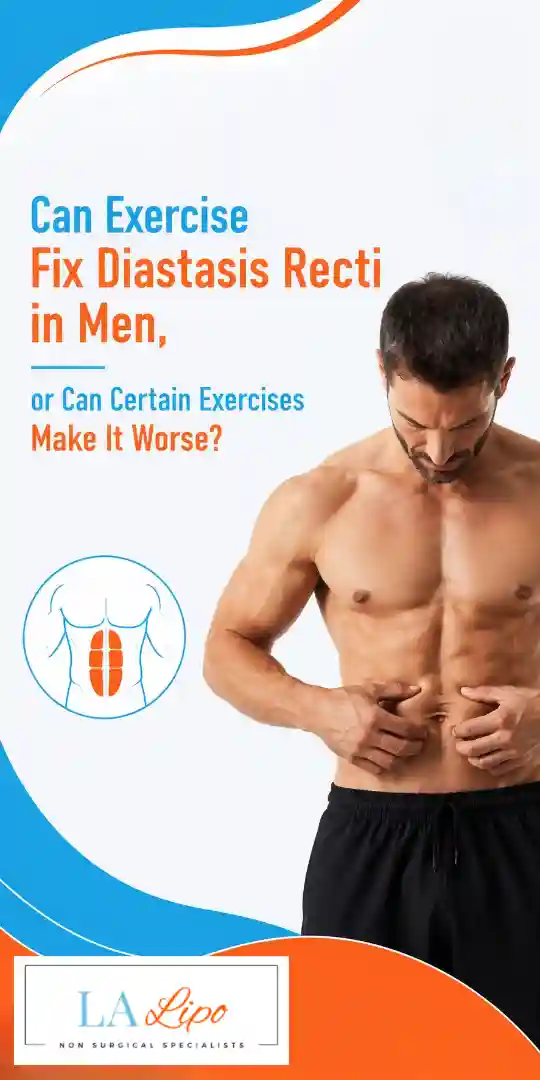 Can Exercise Fix Diastasis Recti in Men, or Can Certain Exercises Make It Worse Kingstanding?